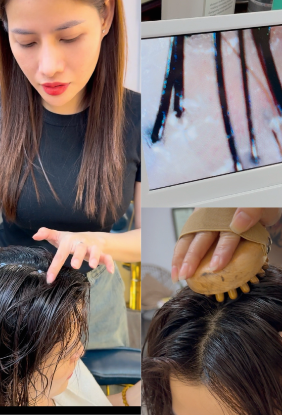 Điều Trị Rụng - Da Đầu
