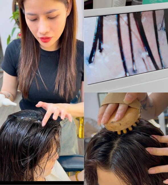 Điều Trị Rụng - Da Đầu